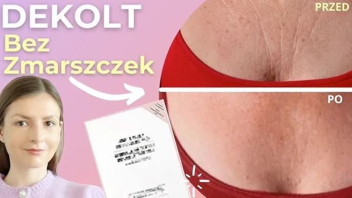 Jak unieść biust: 8 skutecznych sposobów na piękny dekolt
